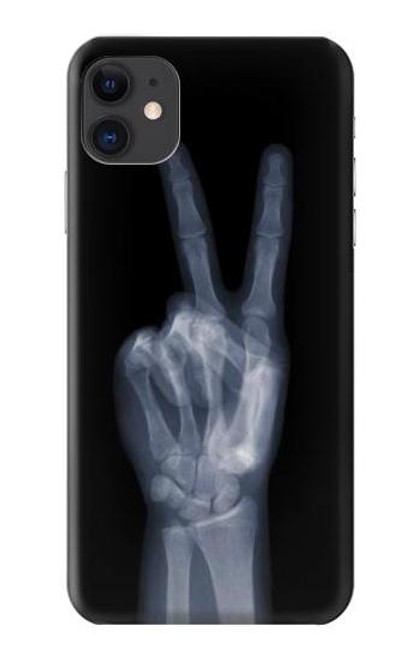 S3101 X-ray Peace Sign Fingers Funda Carcasa Case para iPhone 11