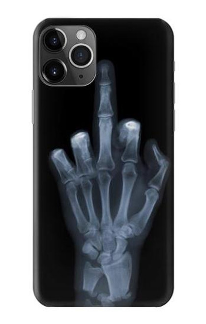 S1143 X-ray Hand Middle Finger Funda Carcasa Case para iPhone 11 Pro Max