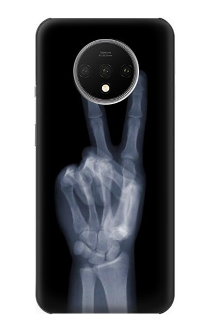 S3101 X-ray Peace Sign Fingers Funda Carcasa Case para OnePlus 7T