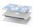 S3681 Daisy Flowers Pattern Funda Carcasa Case para MacBook Air 13″ - A1932, A2179, A2337