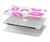 S2214 Pink Lips Kisses Funda Carcasa Case para MacBook Pro Retina 13″ - A1425, A1502