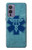 S3824 Caduceus Medical Symbol Funda Carcasa Case para OnePlus 9