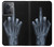 S1143 X-ray Hand Middle Finger Funda Carcasa Case para OnePlus 10R