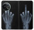 S1143 X-ray Hand Middle Finger Funda Carcasa Case para OnePlus 11