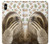 S3559 Sloth Pattern Funda Carcasa Case para iPhone XS Max