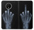 S1143 X-ray Hand Middle Finger Funda Carcasa Case para OnePlus 7T