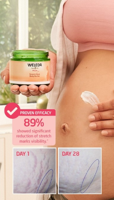 Weleda Stretch Mark Body Butter 150ml