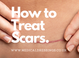 How To Treat Scars