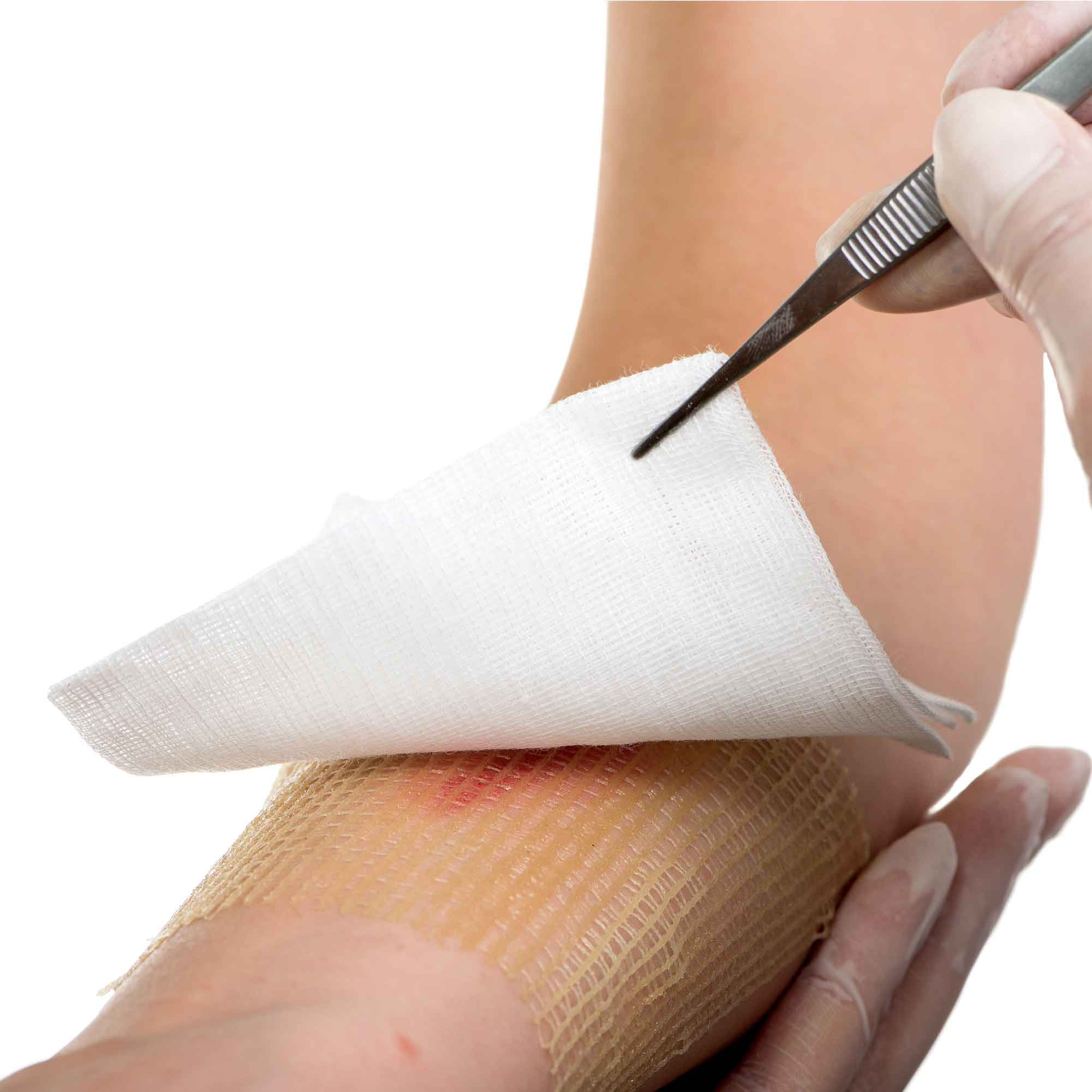 Wound Care Gauze & Dressings MedicalDressings