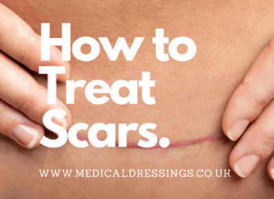 How To Treat Scars