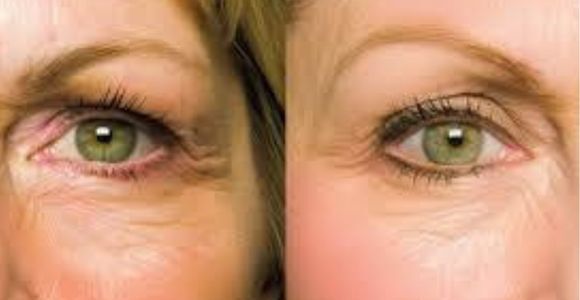 Cacao Bella™ Reduced Wrinkles Fine Lines