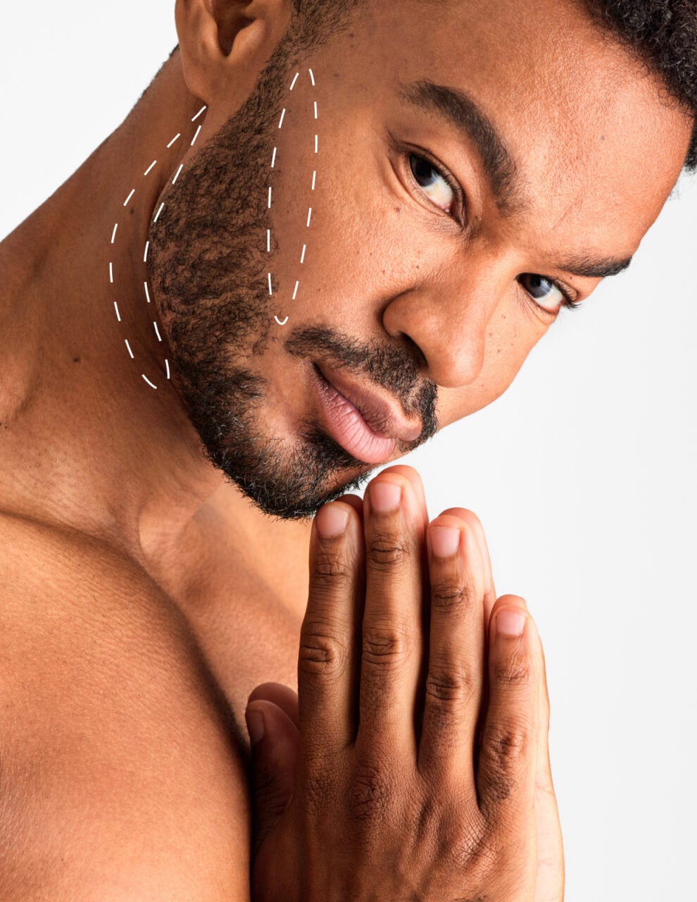 Laser Hair Removal Beard Sculpting | Laser Clinics United Kingdom