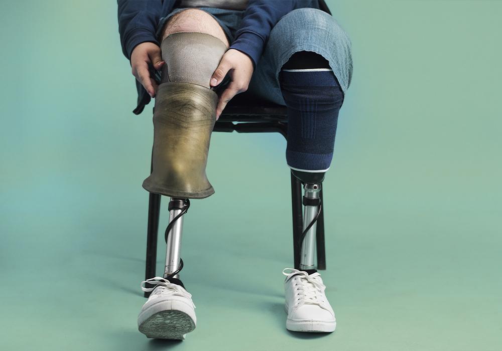 Especialistas en Ortopedia en Farmacia Oca en San Blas-Canillejas