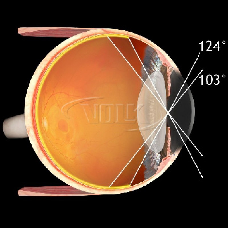 Volk Digital Wide Field Diagnostic Lens, Volk Wide Field