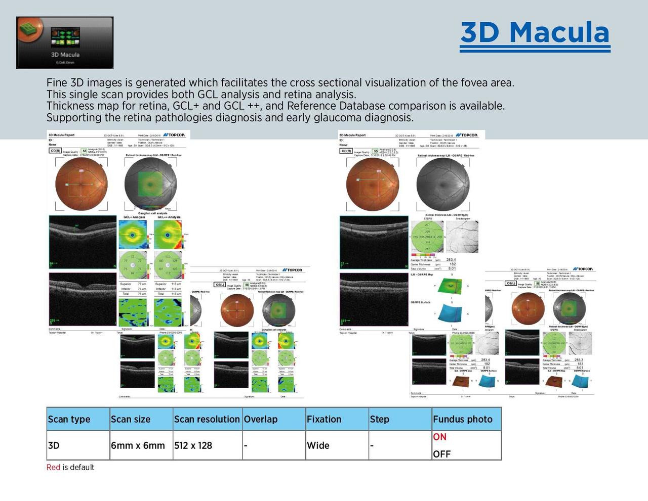 Topcon Maestro2 OCT