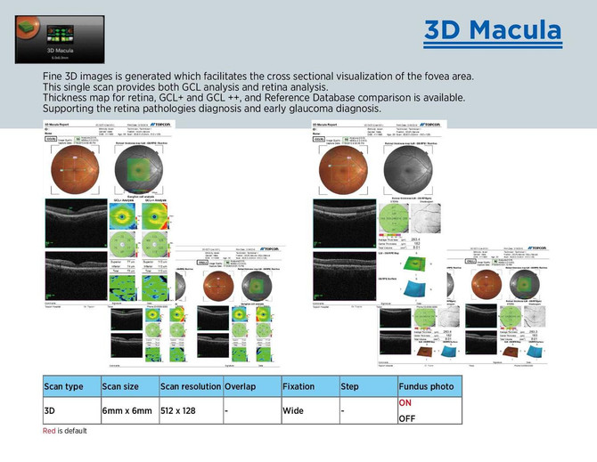 Topcon Maestro2 OCT