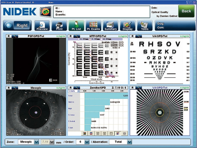 Cataract Summary