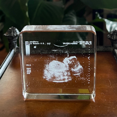 How To Turn Your Sonogram Ultrasound Into The Perfect Keepsake