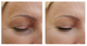 JoliPro IPL Photofacial Laser Home Device