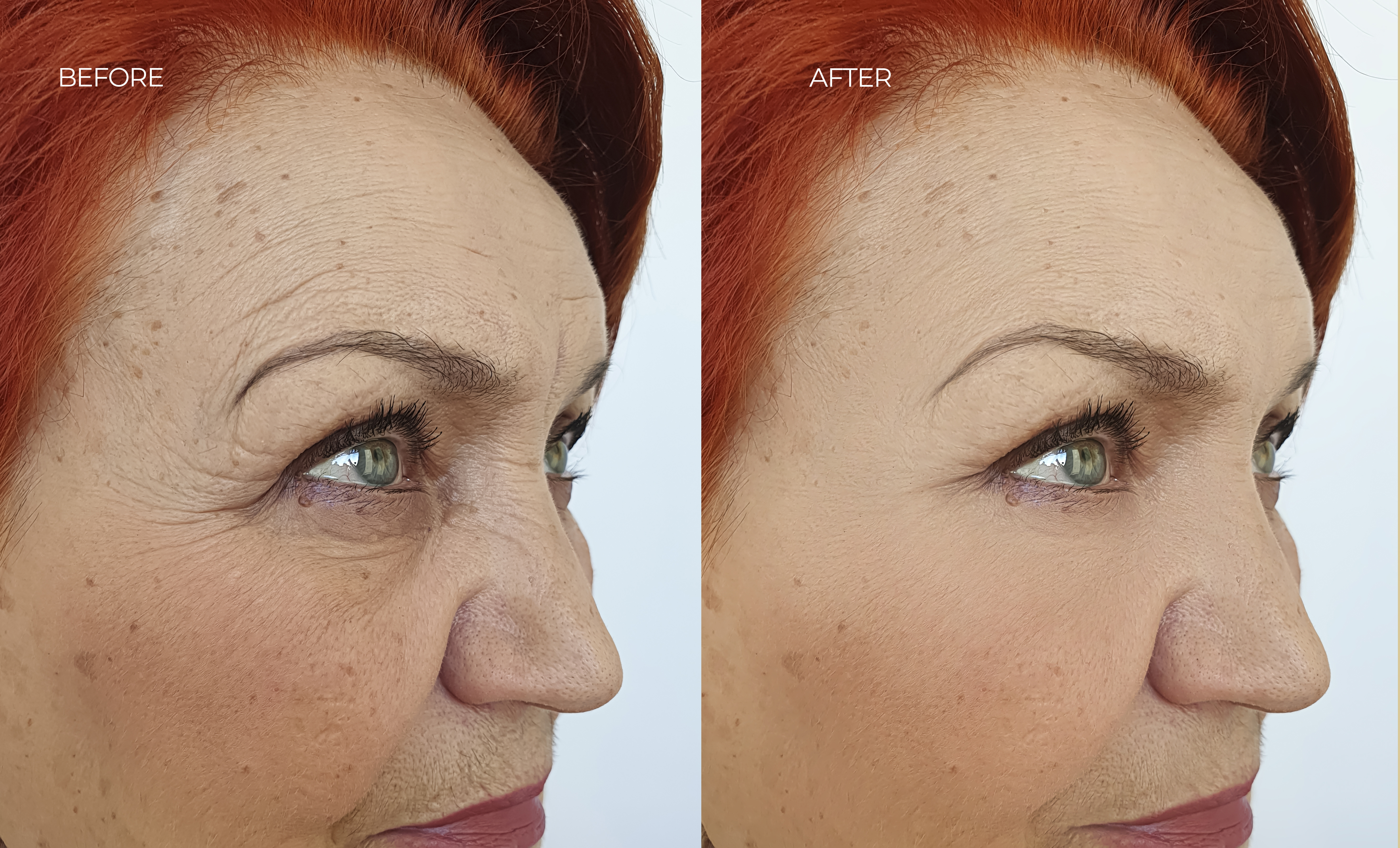 before-after-1.jpg before-after-1.jpg