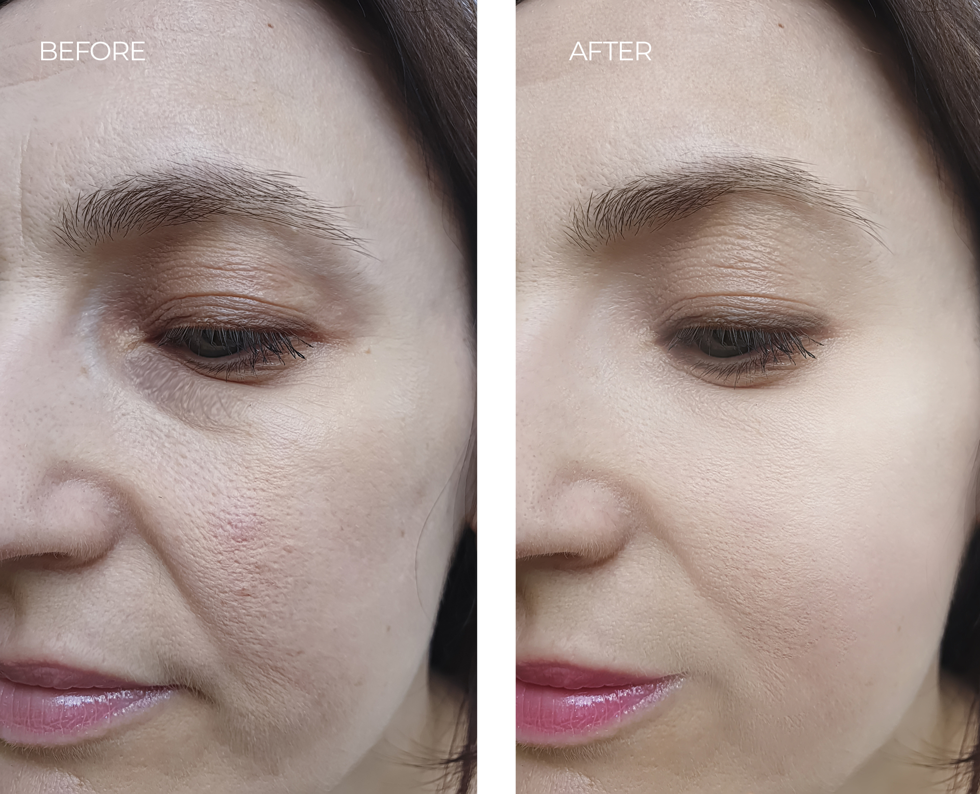 before-after-2.jpg before-after-2.jpg