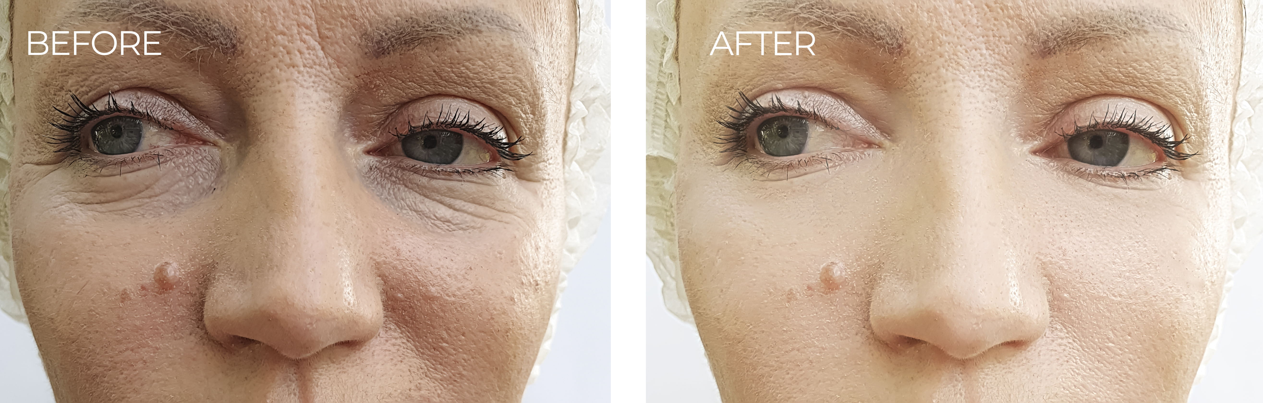 before-after-3.jpg before-after-3.jpg