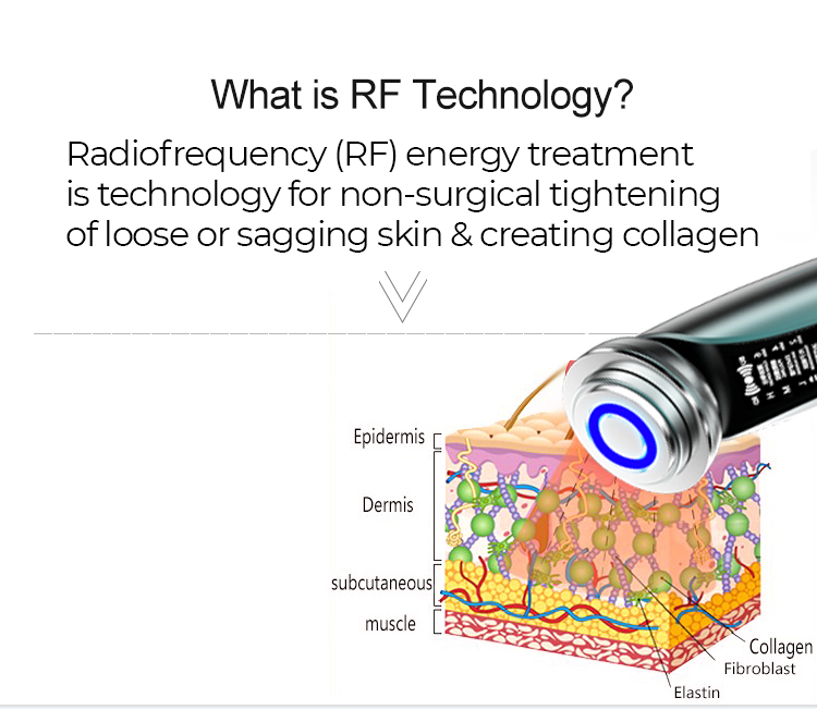 rf-tech.jpg rf-tech.jpg