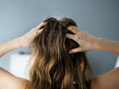Ultimate Guide to Managing Scalp Sensitivity: Solutions for Dandruff, Greasy Scalp, and Itchy Scalp