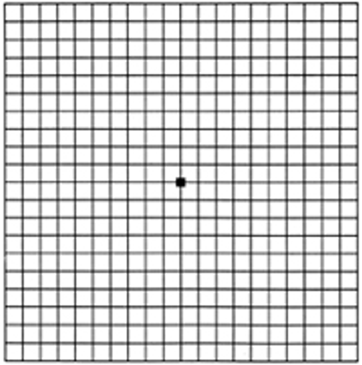 Amsler Test: A Brief Study On It's Practical Application