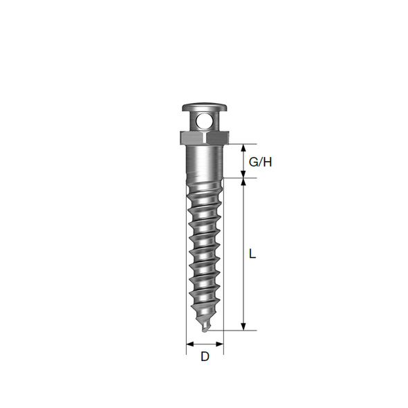 OrthAnchor (Through Hole)