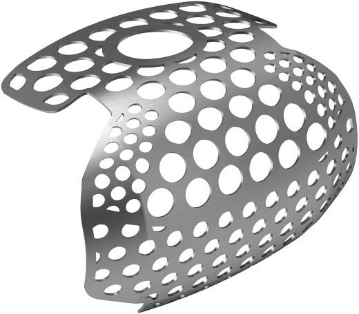 OssBuilder (Lateral Builder) 2 Wall