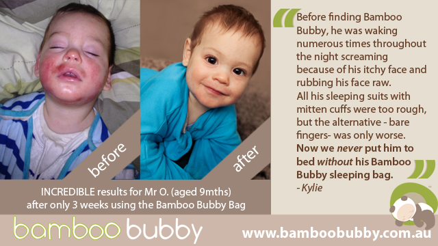 photo-testimonial-before-after-mr-o-9mths-bbb.jpg
