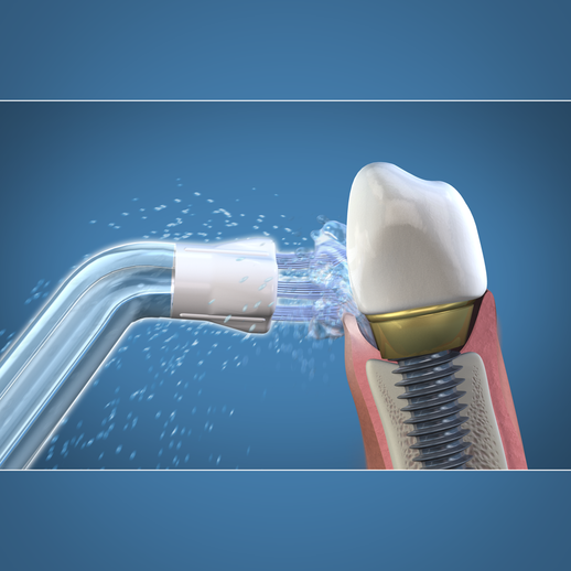 ​Nâng cao sức khỏe cho bệnh nhân cấy ghép implant bằng máy tăm nước với đầu xịt Plaque Seeker.