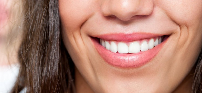 Các câu hỏi thường gặp khi tẩy trắng răng