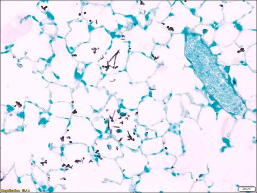 silver methenamine