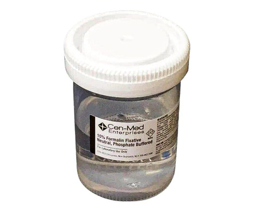 10% formalin buffered, 8oz. 1/2 filled