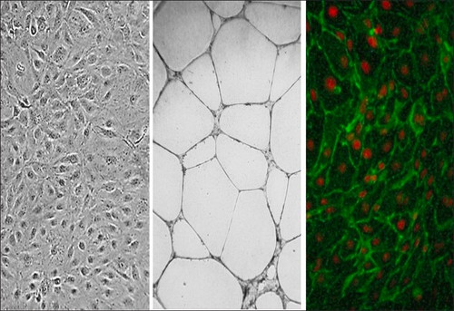 human dermal microvascular endothelial cells: cadmec/hmvec, neonatal