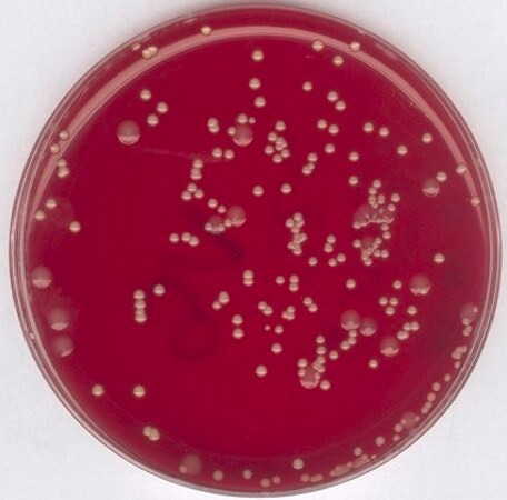 staphylococcus enrichment broth (base) &