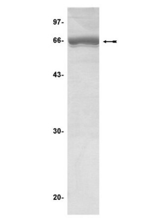 mapkap kinase 2 protein, inactive, 50 g