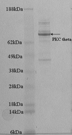 pkc theta protein, active, 10 µg