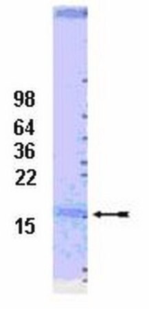 ubch7 conjugating enzyme, 100 µg