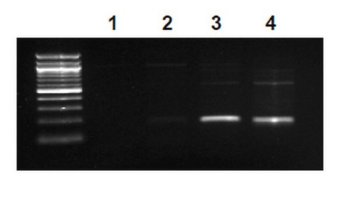 ez-magna chip a - chromatin immunoprecipitation kit