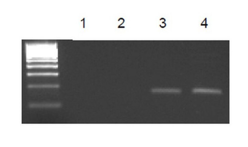 ez-magna chip g - chromatin immunoprecipitation kit