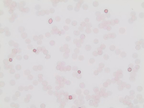 fetal hemoglobin kit (c15-1302-394)