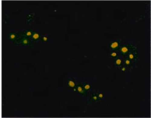 anti-farnesyl rabbit pab (c15-1302-924)