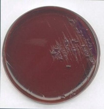levine emb agar (c15-1307-123)