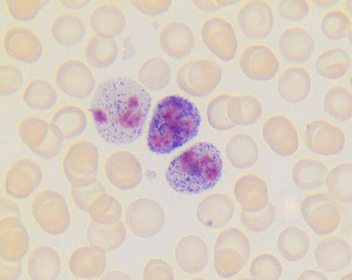 leukocyte alkaline phosphatase kit (c15-1310-914)