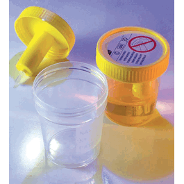 transfertop urine collection cup with integrated transfer device, 4oz (120ml), graduated to 100ml, sterile, bulk, affixed temperature strip (c062b-011645)