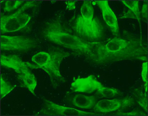 human renal proximal tubular epithelial cells: hrptepc, adult (c15-1313-422)
