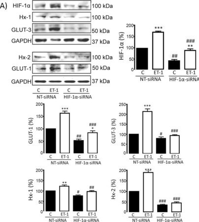 anti-glucose transporter glut-3 antibody, ct (c15-1315-701)